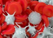 Apa Penyebab Leukosit Tinggi?